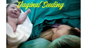 Vaginal Seeding